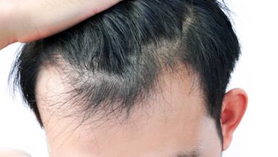 With Bonus Tip: Reverse Receding Hairline and Regrow Hair for Men